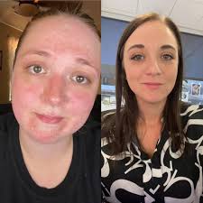 73 days sober today 💪😊♎️👑