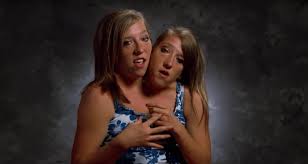 The twins grew up with a younger brother and a younger sister. Abby And Brittany Hensel Are The World S Most Famous Conjoined Twins