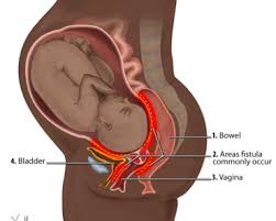 Can i dye my hair while pregnant? Is It Safe To Bleach My Body Hair During Pregnancy The Pulse