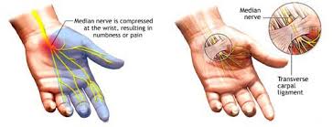 Image result for karp ln  tunel ort za