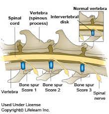 Humans have 206, but the cat has 230 (some cites list 245 bones, and state that bones may fuse together as the cat ages). Spondylosis Deformans In Cats Vca Animal Hospital