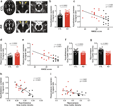 Raul santos seixas nasceu às 8 horas da manhã em 28 de junho de 1945 numa família de classe média baiana, a qual vivia na avenida sete de setembro, salvador. Pro Inflammatory Interleukin 6 Signaling Links Cognitive Impairments And Peripheral Metabolic Alterations In Alzheimer S Disease Translational Psychiatry
