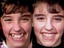 By carefully choosing a toothbrush and making sure to thoroughly brush around and between your braces, you can have clean and gleaming teeth—and. Time Lapse Shows How Braces Work
