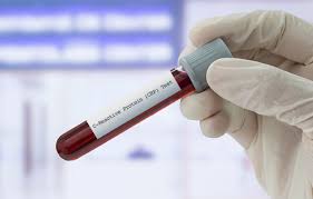 Elevated Level Of C Reactive Protein May Predict Risk For Worsening Covid 19 Infectious Disease Advisor