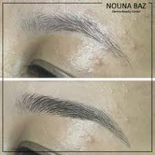 100m consumers helped this year. Nouna Baz Derma Beauty Center Nounabaz Profile Pinterest