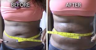 How To Easily Remove Belly Fat Using Vicks Vapor Rub