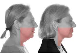 Dr. Joan Ramon Garces Gatnau