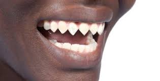 Read the most popular bodymodification stories on wattpad, the world's largest social storytelling platform. Sharp Teeth Body Modifications Body Mods Body