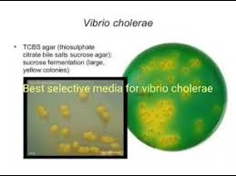 Tcbs agar is highly selective for the isolation of v. Tcbs Selective Culture Media For Vibrio Cholerae Youtube