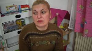 Cand spunem polipi nazali ne referim la formatiuni tumorale prezente in fosele nazale, ce apar in urma degenerarii edematoase a mucoasei nazale (polipoza. Miros Urat Dupa Operatie De Polipi Rinoadenoidita CronicÄ Polipii Nazali