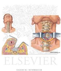 Welcome To Netter Images Cervical Brain Surgery Approach