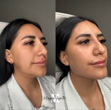 𝐌𝐚𝐲𝐫𝐚 𝐆𝐚𝐦𝐛𝐨𝐚 𝐁𝐒𝐍, 𝐑𝐍