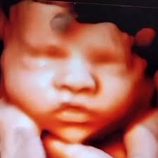 Seeing you Baby face before he/she arrives is the Best feeling ever 🥰🥰  Book now! 24/7 www.mybabydebut.com