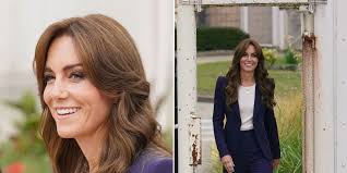 Princess Kate reveals injury