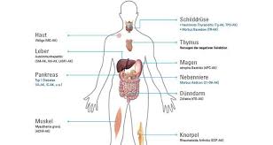 Den größten teil seines bedarfs an. Vitamin D Mangel Ein Risikofaktor Fur Diabetes Aktuelles Aus Der Goethe Universitat Frankfurt