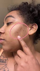 Please help,I have white spots