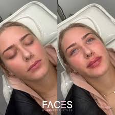 Best Facial Balancing in Nyc