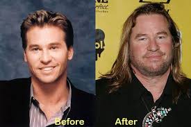Famous faces gorgeous men movie stars val handsome hollywood actors val kilmer hollywood stars. The 25 Worst Aging Actors In Hollywood Ohnotheydidnt Livejournal Val Kilmer Actors Action Movie Stars