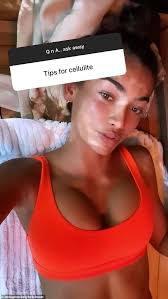 Kelly stays healthy by maintaining a strict exercise routine for both the physical and mental benefits and following an even stricter diet. Victoria S Secret Model Kelly Gale Reveals Her Surprising Secret To Fighting Cellulite Sound Health And Lasting Wealth