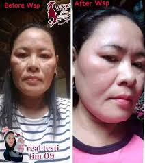 PM bosok iha timor tama to malae nia Rai malae mos rona Doko Ulun deit 😋😋 