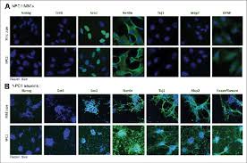 Engineered with 99.4% tracking accuracy and up to 16,000 dpi, the razer 5g optical sensor offers deadly precision. A Immunofluorescence Staining Of Neural Stem Cell Nsc Markers The Download Scientific Diagram