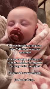 Daisy Odonnell Surgery