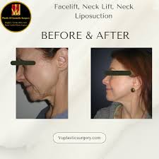 Vu Plastic & Cosmetic Surgery