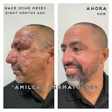 Amílcar G. Rodríguez,MD,FAAD (@amilcardermatology) • Instagram photos and  videos