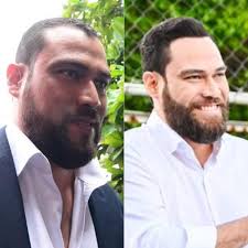 El Alcalde Mario Duran reaparece en público luego de 2 meses con nuevo  look, operación de nariz, de cejas e injerto de cabello.