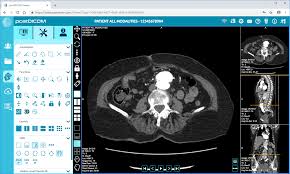 Best Free Online Dicom Viewer With 50 Gb Free Storage Postdicom