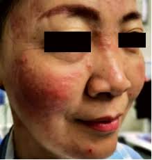 Patient Preference and Adherence