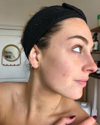 Call me the 🐐🧚🏼‍♀️ ! Swipe for incredible transformation + video  content. Thank y'all for trusting me with your precious skins.  #integrativeesthetican #skinhack #skinhealth #skinrituals #ritualbodystudio  #holisticesthetician #integrativeacne ...