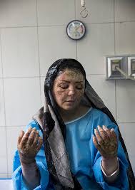Ouvir lawrence de arabia hombres g. Acid Attack Wikiwand