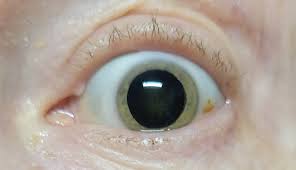 Image result for Pupil