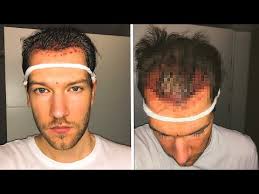The latest tweets from @apecrime Video Jan Meyer