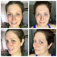 How are you taking care of your skin after pregnancy? I've been breaking  out, and I avoided using skincare products during pregnancy because I heard  some of them could affect the baby