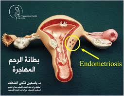 Dr Yasmine Fathi دكتورة ياسمين فتحى Home Facebook