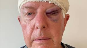 Coulton's wake-up call