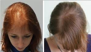 وصفة لتكثير الشعر تكثيف الشعر بطريقة سهلة تسريحات تجنن