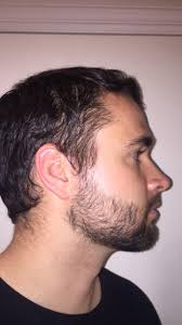 I would recommend waxing (or. Any Tips On Dealing With A Spiral Cowlick In My Beard Beards