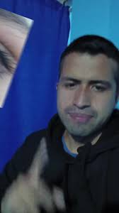 Pliegue de Dennie Morgan #medicina