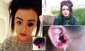 A person may face difficulty in sleeping. The Girl Who Bleeds From Her Eyes And Ears Daily Mail Online