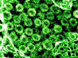 Linea De Tiempo Del Coronavirus Del Corazon A Rinones Higado Y Hasta Cerebro Los Angeles Times