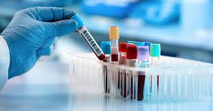 Les hommes ayant une … Improved Precision In Prostate Cancer Diagnosis With The Prostate Health Index Test