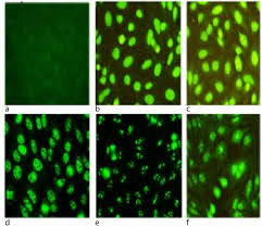 Image result for ANA Staining Pattern