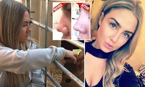 How to get a new nose WITHOUT going under the knife