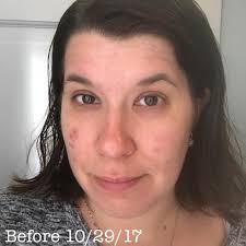 Three large packs of exfoliating cotton rounds for under $6