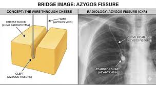 Image result for Silhouette Sign