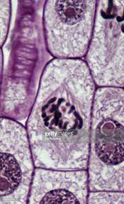 Prophase 500x At 35mm Onion Root Tip Shows Chromosomes Spindle Plant Cell Cell Wall Chromosome