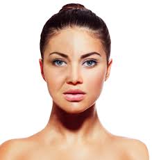 The latest treatments from Turkle & Associates, The Synergy Spa and The  Laser and Skin Surgery Center of Indiana